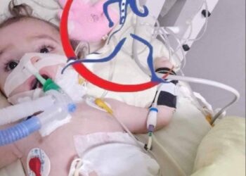 مرضى ضمور العضلات ..معاناة متواصلة وعلاجات متعثرة