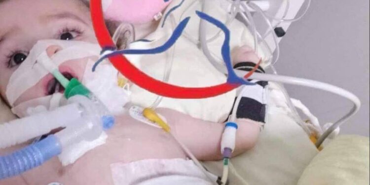 مرضى ضمور العضلات ..معاناة متواصلة وعلاجات متعثرة